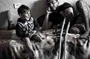 WAEL AL-NAMLA HIS WIFE ISRAA AND HIS SON , THREE OF THEM LOST THE LOWER LIMBS DURING 